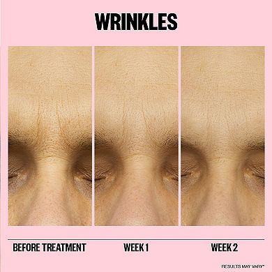 Microneedling Anti-Wrinkle Retinol Patches