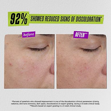 Auto-Tone Skin Discoloration Treatment with SPF 30