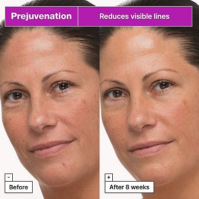 Prejuvenation Firming Bakuchiol Cream for Preventative Aging