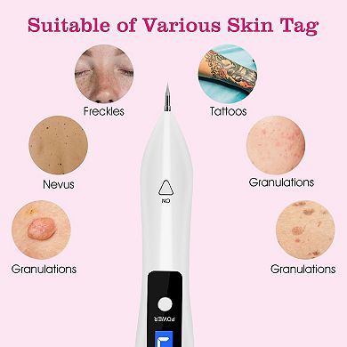 Skin Tag Repair Kit - Portable Beauty Equipment, Usb Charging, Lcd Display