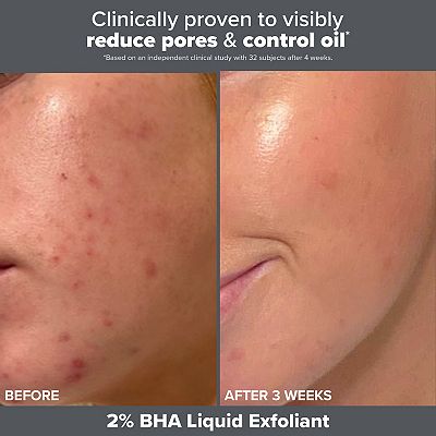 Paula's Choice The Exfoliation Experience Kit with 2% BHA + 6% Mandelic Acid AHA