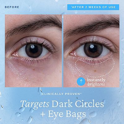 belif Aqua Bomb Depuffing Eye Gel with Caffeine + Hyaluronic Acid