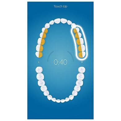 Philips Sonicare DiamondClean Smart 9700 Series Electric Toothbrush with Bluetooth