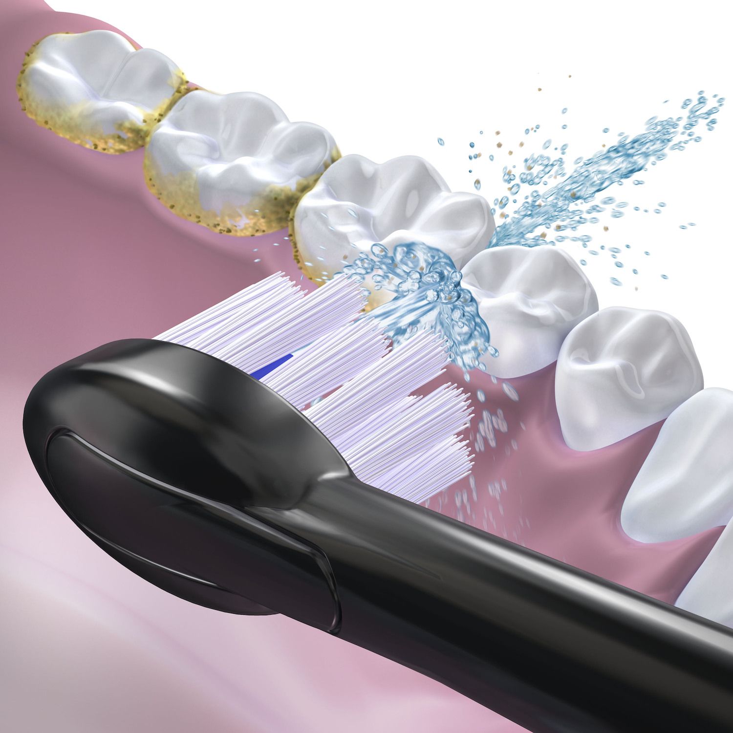 sonic toothbrush with floss