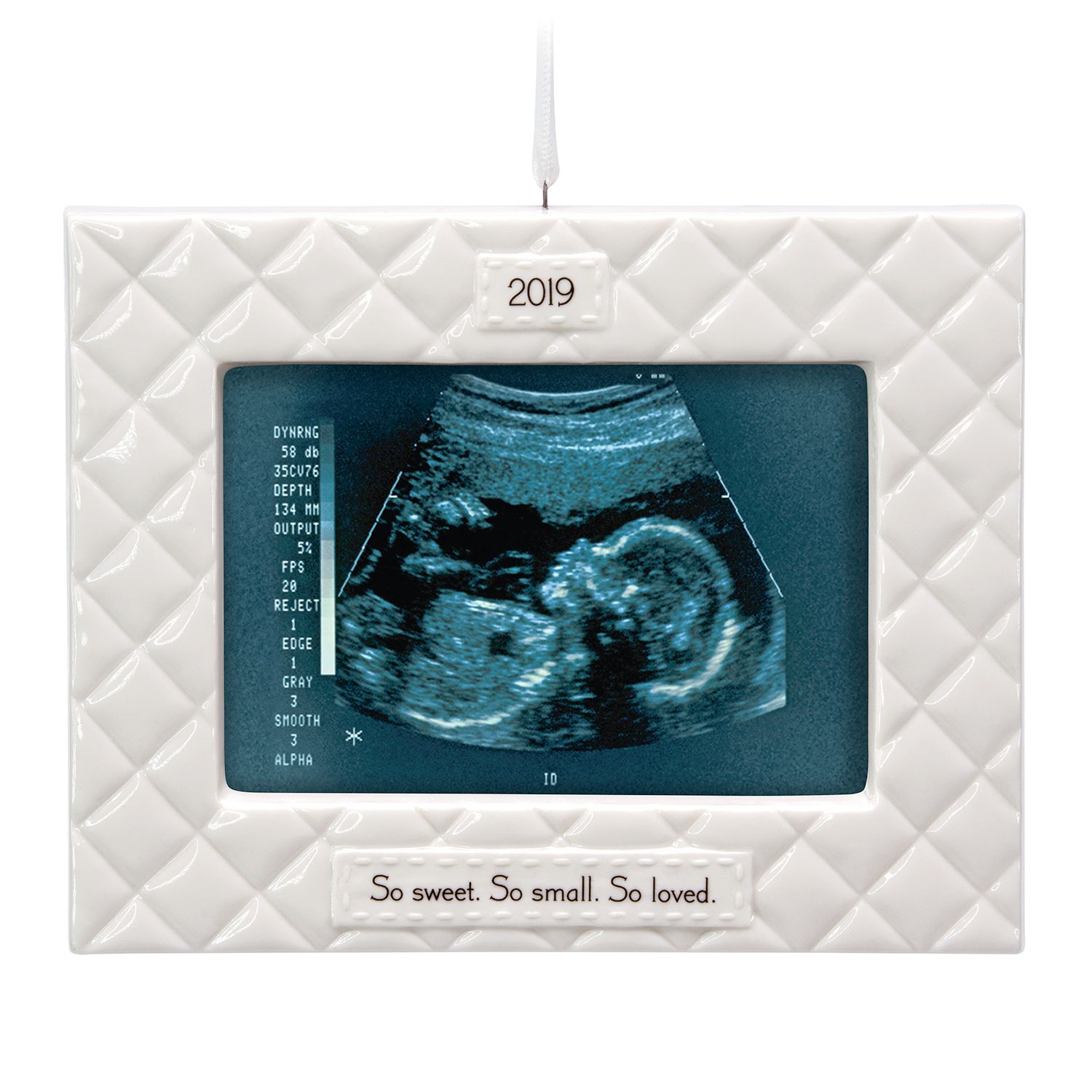 sonogram ornament