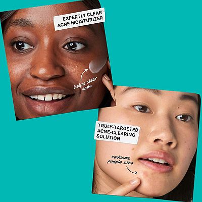 Reproskin Acne St. Care Lotion 3本セット Kiehl's Since 1851 Ditch The Zituation Gift Set for Acne-Prone Skin