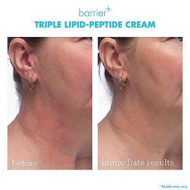 barrier+ Strengthening and Moisturizing Triple Lipid-Peptide Refillable Cream with B-L3