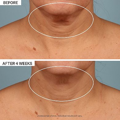 TL Advanced Tightening Neck Cream PLUS for Firming & Brightening