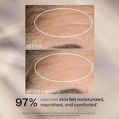 Advanced Retinol Nightly Renewal Face Moisturizer with Retinol