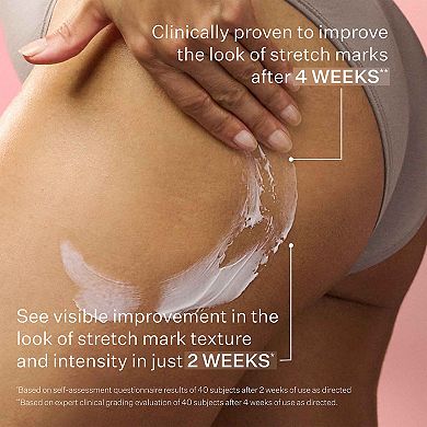 SD Advanced PLUS Intensive Moisturizer for Stretchmarks and Wrinkles