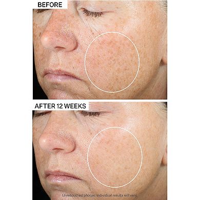 Super-C Retinol Brighten & Correct Vitamin C Serum