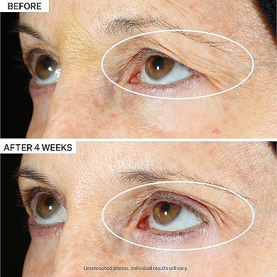 Peptight 360 Tightening Eye Serum