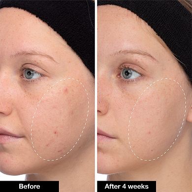 Slushy Serum Moisturizer Crush Infused with Bakuchiol