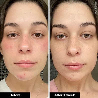 Slushy Serum Moisturizer Crush Infused with Bakuchiol