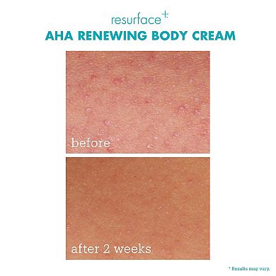 Resurface+ AHA Renewing Body Cream