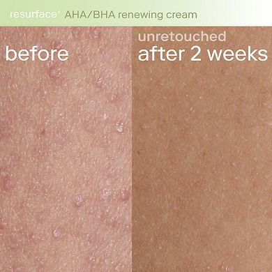 Resurface+ AHA Renewing Body Cream