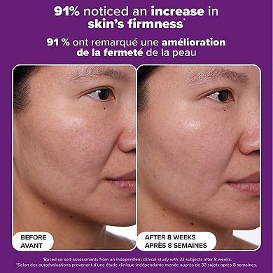 CLINICAL Anti-Aging 1% Retinol Treatment