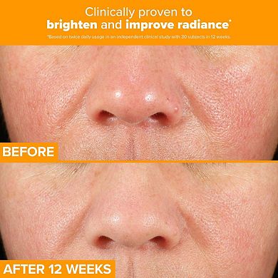 C15 Super Booster for Brightening Dullness & Uneven Tone