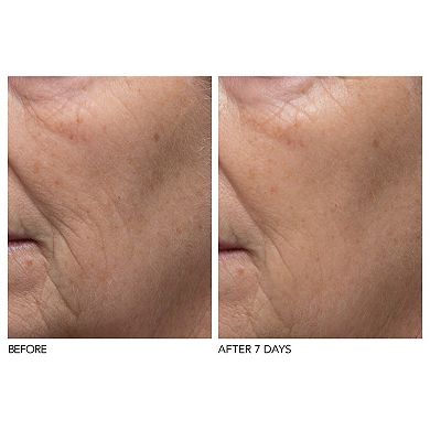 Alpha Beta Pore Perfecting Moisturizer