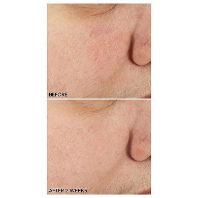 Stress Repair Face Cream with Niacinamide