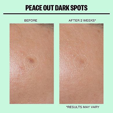 Microneedling Dark Spot Brightening Dots