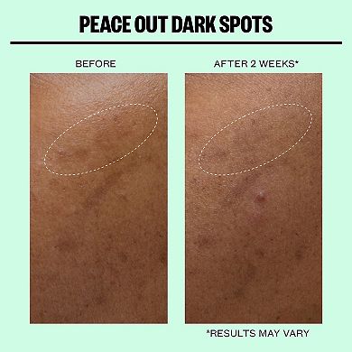 Microneedling Dark Spot Brightening Dots