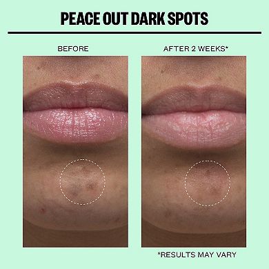 Microneedling Dark Spot Brightening Dots