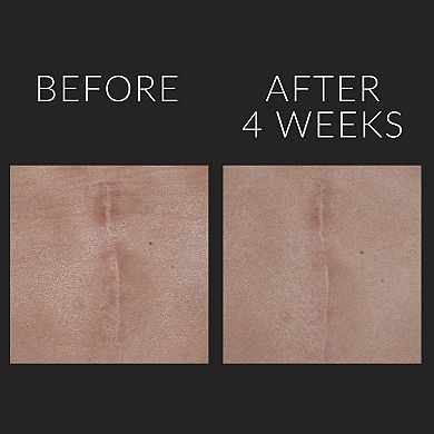 D-Scar Scar Diminishing Serum