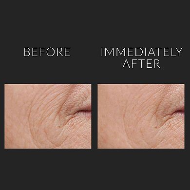 DermalQuench Hyaluronic Acid Hydration Treatment