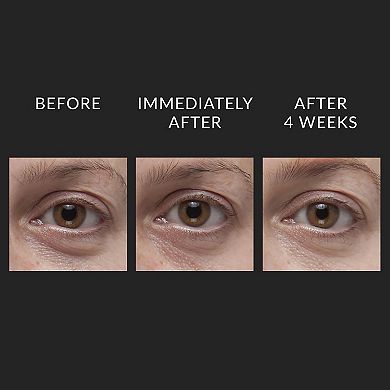 DermalQuench Hyaluronic Acid Hydration Treatment