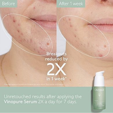 Vinopure Natural Salicylic Acid Pore Minimizing Serum