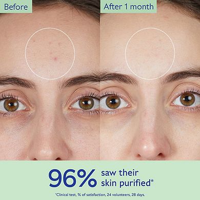 Vinopure Pore Purifying Gel Cleanser