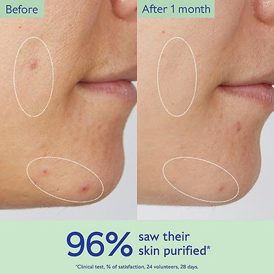 Vinopure Pore Purifying Gel Cleanser