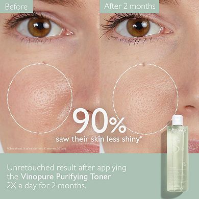 Vinopure Natural Salicylic Acid Pore Minimizing Toner