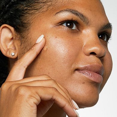 Mini Acne Solutions Clinical Clearing Gel