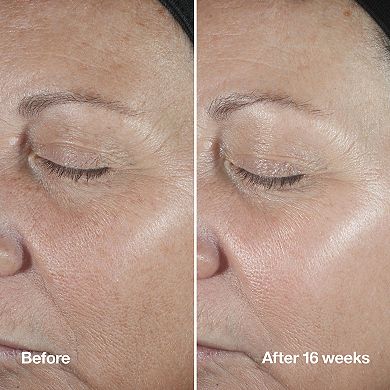 Smart Clinical Repair Wrinkle Correcting Anti-Aging Serum with 1% Retinoid