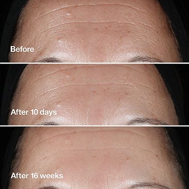 Smart Clinical Repair Wrinkle Correcting Anti-Aging Serum with 1% Retinoid