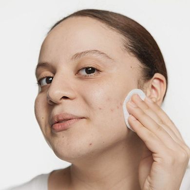 Acne Solutions Clarifying Lotion Liquid Exfoliator with Salicylic Acid