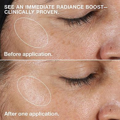 Clarifying Face Lotion 2 Liquid Exfoliator for Dry Combination Skin