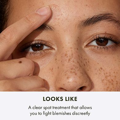 Super Spot Remover Acne Treatment Gel with Salicylic Acid