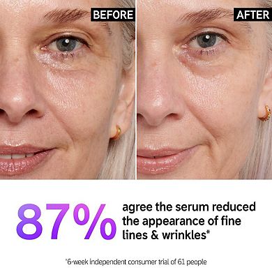 Retinol Fine Lines and Wrinkles Serum