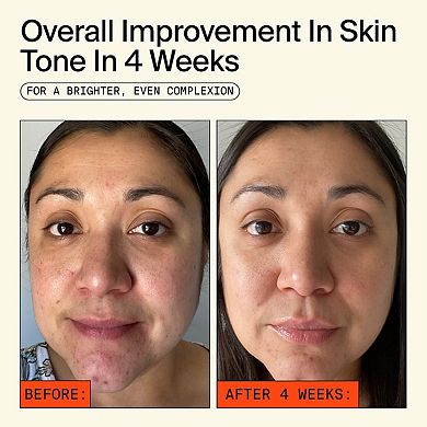 15% Vitamin C + Caffeine Energy Brightening Serum for Uneven Tone