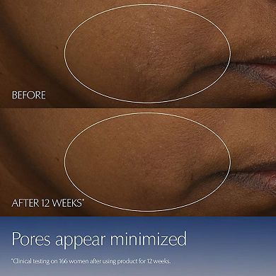 Advanced Night Repair Synchronized Multi-Recovery Complex Serum Duo with Hyaluronic Acid