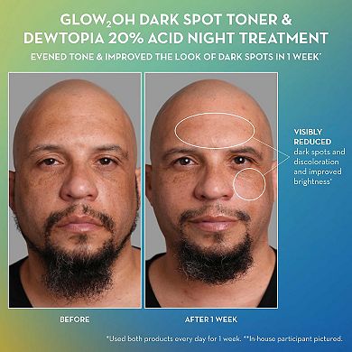 Glow2OH 7% AHA Exfoliating Dark Spot Toner