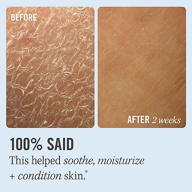 Ultra Repair Cream Intense Hydration Face and Body Moisturizer for Skin Repair