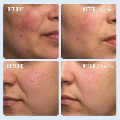 Ultra Repair Cream Intense Hydration Face and Body Moisturizer for Skin Repair