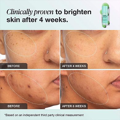 Green Machine Vitamin C Dark Spot & Hyperpigmentation Serum
