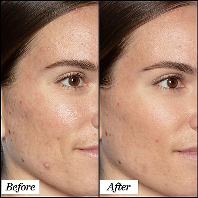 Good Genes All-In-One Lactic Acid Serum For Dark Spots And Uneven Texture