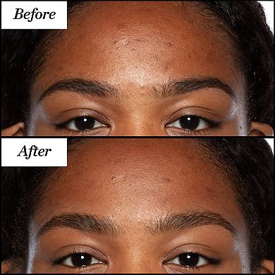 Good Genes All-In-One Lactic Acid Serum For Dark Spots And Uneven Texture