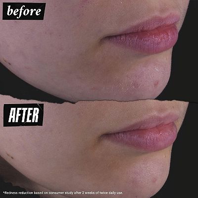 Kiehl's Since 1851 Calendula Herbal Extract Alcohol Free Toner